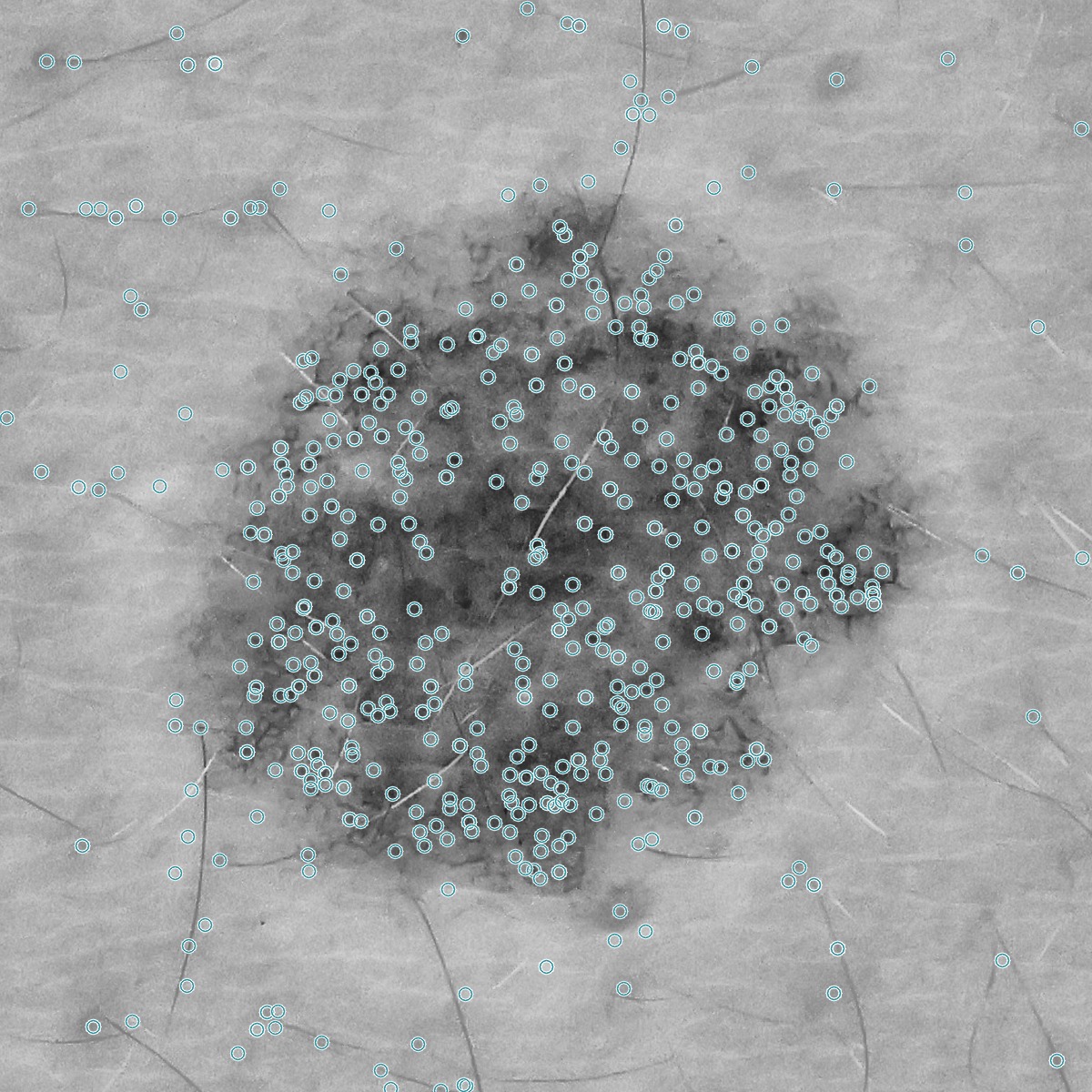 Square CLAHE-equalized skin crop with the mole centered and SIFT keypoints marked as small teal rings