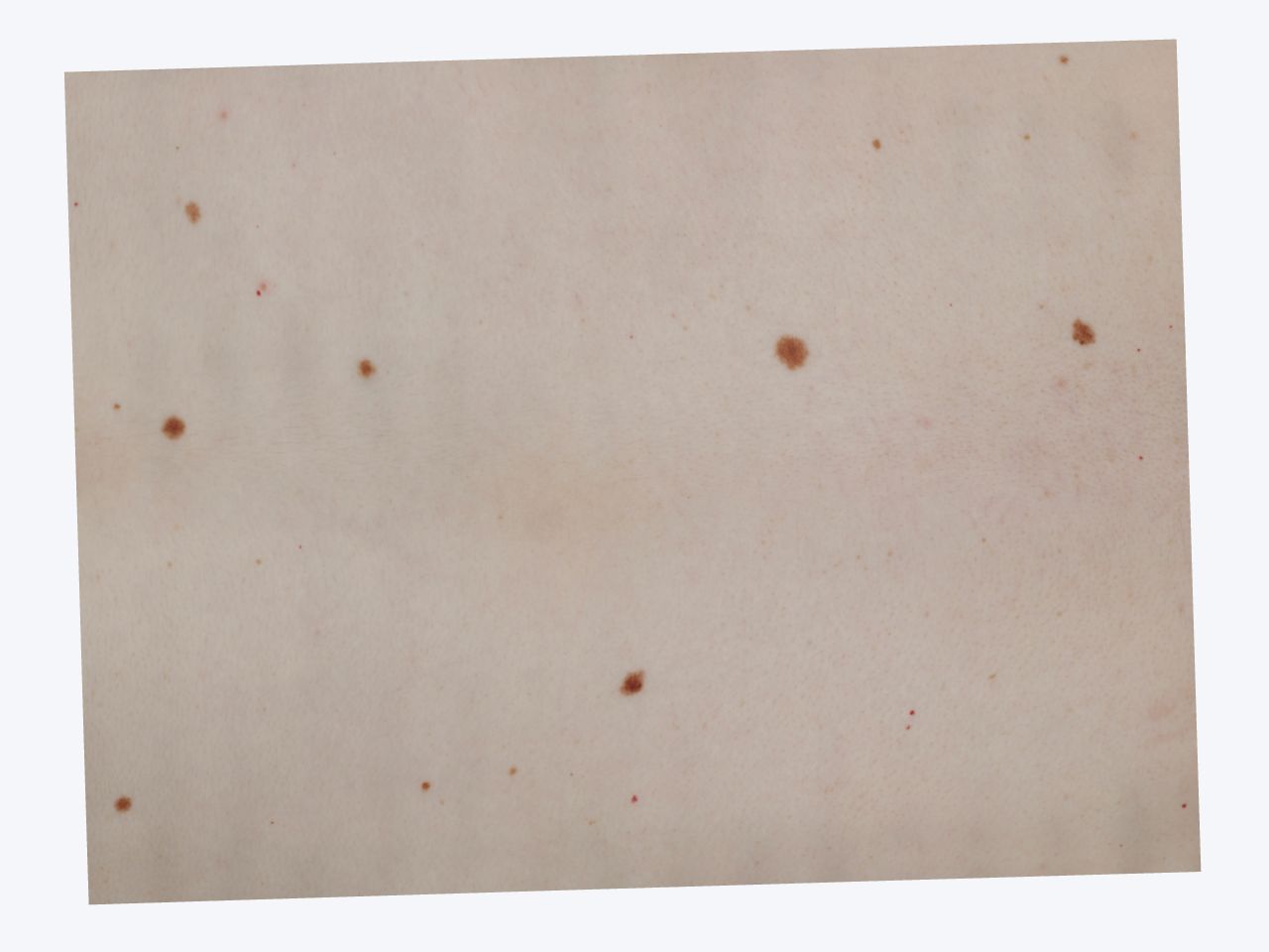 The full 3D skin reconstruction with its clean cropped mesh boundary