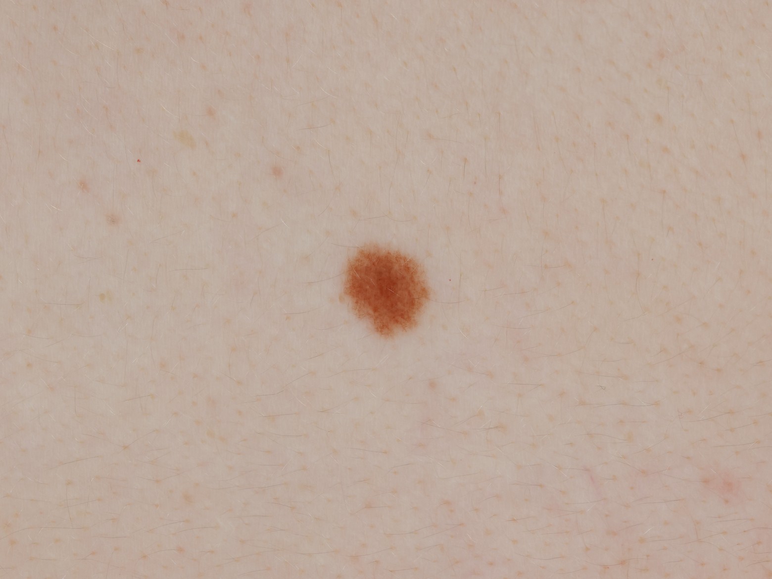 80 millimeter wide region of the atlas around a mole
